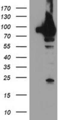 Western Blot: TRAP1 Antibody (OTI1H8) [NBP2-01707]