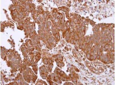 Immunohistochemistry-Paraffin: TRAP1 Antibody [NBP2-20700]