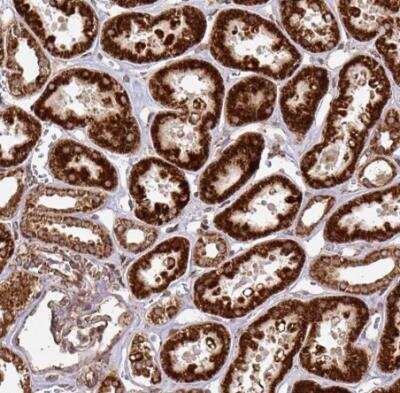 Immunohistochemistry-Paraffin: TRAP1 Antibody [NBP2-47597]