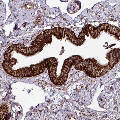 Immunohistochemistry-Paraffin: TRAP1 Antibody [NBP2-47598]
