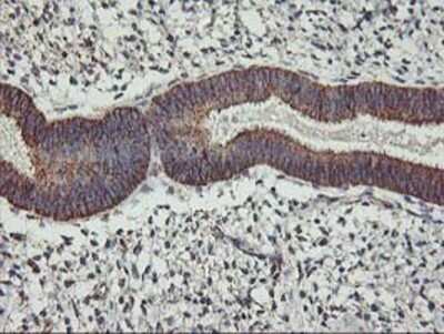 Immunohistochemistry: TRAP1 Antibody (OTI1H8) - Azide and BSA Free [NBP2-74592]