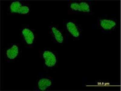 Immunocytochemistry/ Immunofluorescence: TRAP220/MED1 Antibody (2A2) [H00005469-M01]