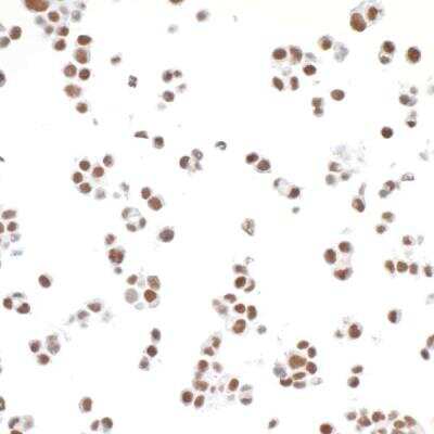 Immunocytochemistry: TRAP220/MED1 Antibody (BLR037F) [NBP2-76407]