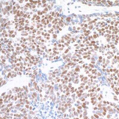 Immunohistochemistry: TRAP220/MED1 Antibody (BLR037F) [NBP2-76407]