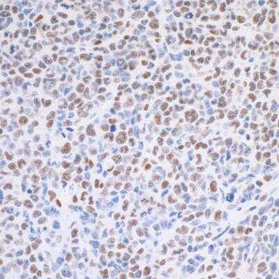 Immunohistochemistry: TRAP220/MED1 Antibody (BLR037F) [NBP2-76407]