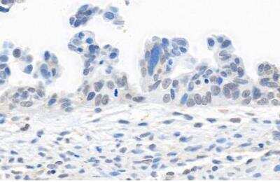 Immunohistochemistry-Paraffin: TRAP220/MED1 Antibody [NB100-2574]