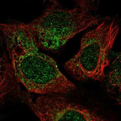 Immunocytochemistry/ Immunofluorescence: TRAPPC2 Antibody [NBP2-56481]