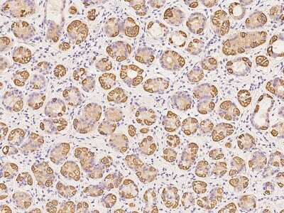 Immunohistochemistry-Paraffin: TRAPPC2L Antibody [NBP2-98640]