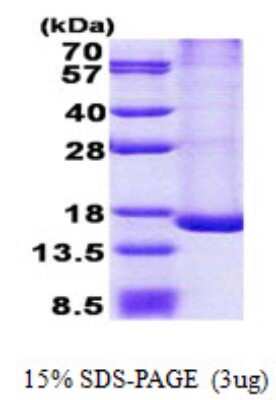 SDS-PAGE: Recombinant Human TRAPPC2L His Protein [NBP2-22644]