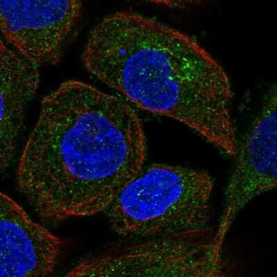 Immunocytochemistry/ Immunofluorescence: TRAPPC3 Antibody [NBP1-88664]