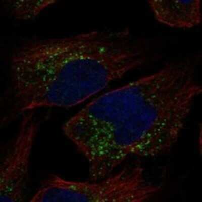 Immunocytochemistry/ Immunofluorescence: TRAPPC3L Antibody [NBP3-17182]