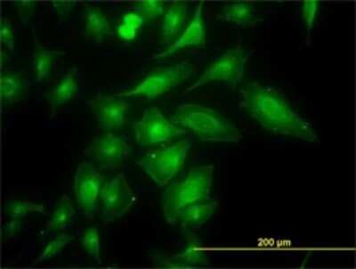 Immunocytochemistry/ Immunofluorescence: TRAPPC4 Antibody (2D10) [H00051399-M01]