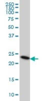 Western Blot: TRAPPC4 Antibody (2D10) [H00051399-M01]