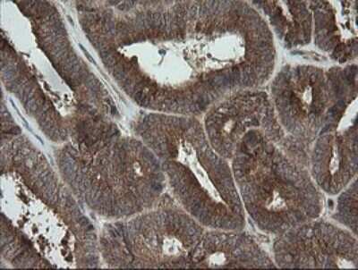 Immunohistochemistry: TRAPPC4 Antibody (OTI2G8) [NBP2-46204]