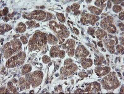 Immunohistochemistry: TRAPPC4 Antibody (OTI2G8) [NBP2-46204]