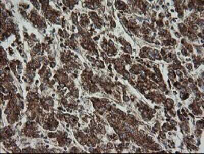 Immunohistochemistry: TRAPPC4 Antibody (OTI2G8) [NBP2-46204]