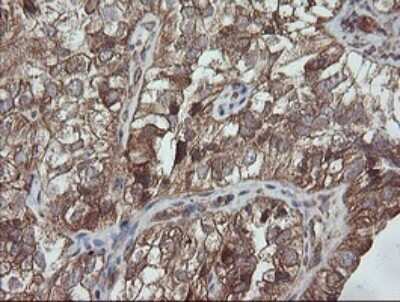 Immunohistochemistry: TRAPPC4 Antibody (OTI2G8) [NBP2-46204]