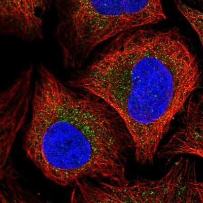 Immunocytochemistry/ Immunofluorescence: TRAPPC4 Antibody [NBP2-13476]