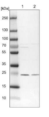 Western Blot: TRAPPC4 Antibody [NBP2-13476]
