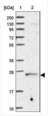 Western Blot: TRAPPC4 Antibody [NBP2-13476]