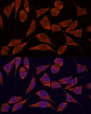Immunocytochemistry/ Immunofluorescence: TRAPPC6A Antibody - Azide and BSA Free [NBP2-94046]