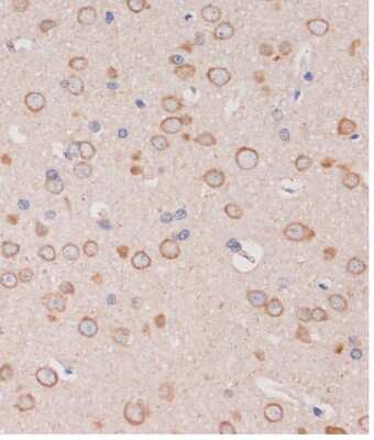 Immunohistochemistry-Paraffin: TRAPPC6B Antibody - Azide and BSA Free [NBP2-93297]