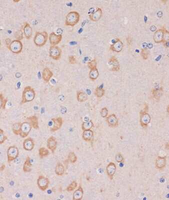 Immunohistochemistry-Paraffin: TRAPPC6B Antibody - Azide and BSA Free [NBP2-93297]