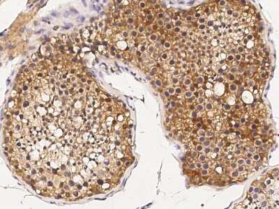 Immunohistochemistry-Paraffin: TRAX Antibody [NBP2-98951]