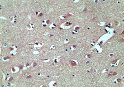 Immunohistochemistry-Paraffin: TRBP Antibody [NBP2-24725]