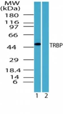 Western Blot: TRBP Antibody [NBP2-24725]