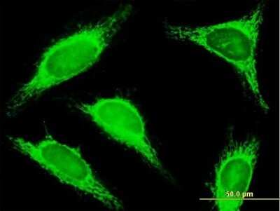 Immunocytochemistry/ Immunofluorescence: TRDD3 Antibody [H00028523-B01P]