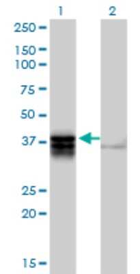 Western Blot: TRDD3 Antibody [H00028523-B01P]