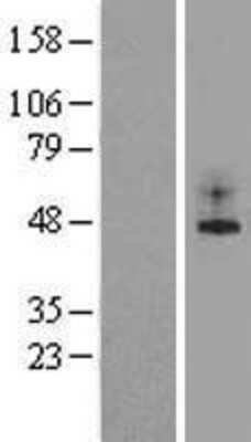Western Blot: TREK 1 Overexpression Lysate [NBL1-12183]