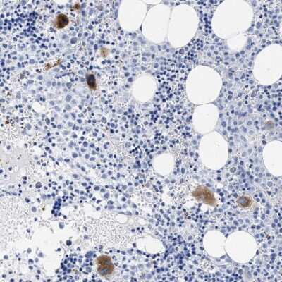 Immunohistochemistry-Paraffin: TREML1/TLT-1 Antibody [NBP1-84234]