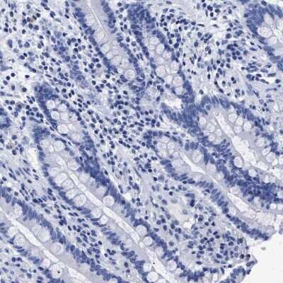 Immunohistochemistry-Paraffin: TREML1/TLT-1 Antibody [NBP1-84234]