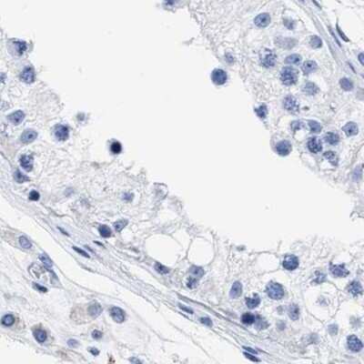 Immunohistochemistry-Paraffin: TREML1/TLT-1 Antibody [NBP1-84234]