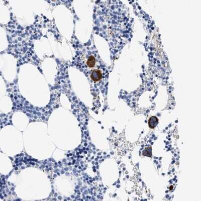 Immunohistochemistry-Paraffin: TREML1/TLT-1 Antibody [NBP1-84235]