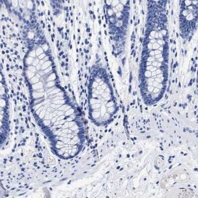 Immunohistochemistry-Paraffin: TREML1/TLT-1 Antibody [NBP1-84235]