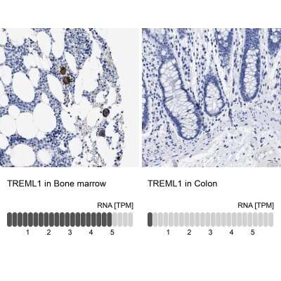 Immunohistochemistry-Paraffin: TREML1/TLT-1 Antibody [NBP1-84235]