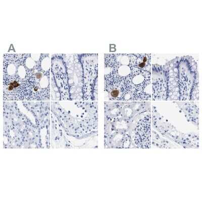 Immunohistochemistry-Paraffin: TREML1/TLT-1 Antibody [NBP1-84235]