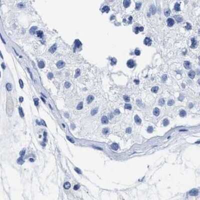 Immunohistochemistry-Paraffin: TREML1/TLT-1 Antibody [NBP1-84235]