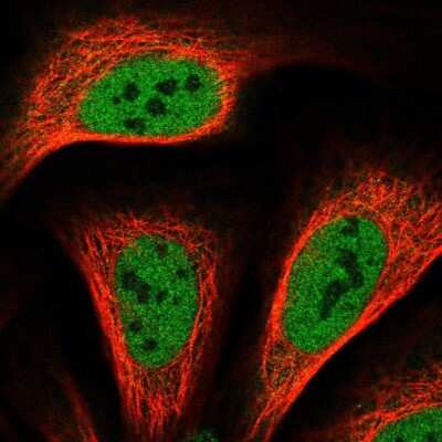 Immunocytochemistry/ Immunofluorescence: TRERF1 Antibody [NBP2-56238]