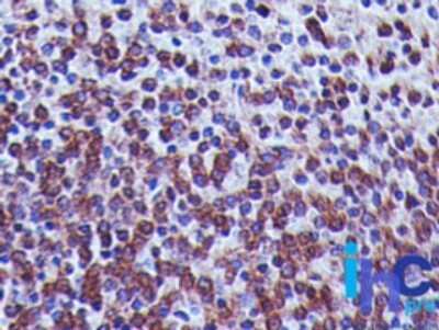 Immunohistochemistry: TREX1 Antibody (41M5F2) - Azide and BSA Free [NBP2-80992]