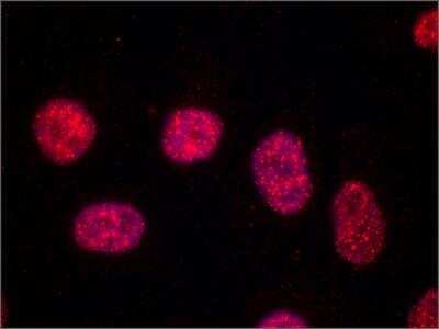 Immunocytochemistry/ Immunofluorescence: TRF-1 Antibody (TRF-78) - BSA Free [NB100-1701]