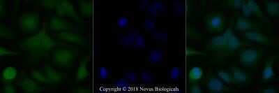 Immunocytochemistry/ Immunofluorescence: TRF-2 Antibody (4A794.15) - Azide Free [NBP2-33212]