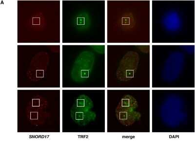 Immunocytochemistry/ Immunofluorescence: TRF-2 Antibody (4A794.15) - BSA Free [NB100-56506]