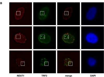 Immunocytochemistry/ Immunofluorescence: TRF-2 Antibody (4A794.15) - BSA Free [NB100-56506]