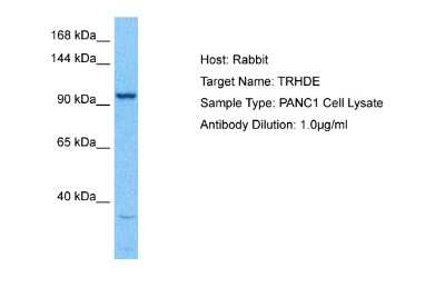 Western Blot: TRH-degrading Ectoenzyme/TRHDE Antibody [NBP2-84311]