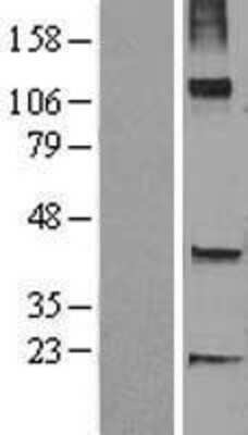 Western Blot: TRH-degrading Ectoenzyme/TRHDE Overexpression Lysate [NBL1-17268]