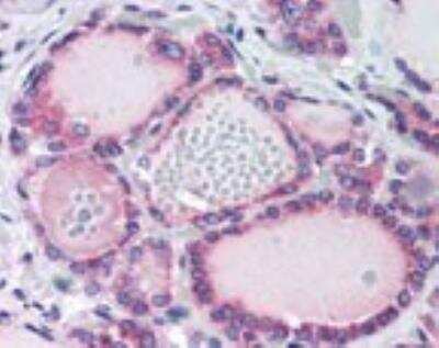 Immunohistochemistry-Paraffin: TRHR Antibody [NBP2-24726]
